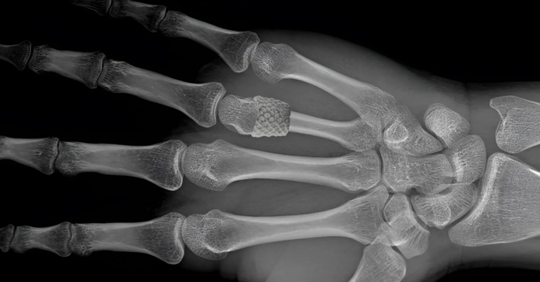 The Future of Medicine: How Biomaterials Are Transforming Healthcare